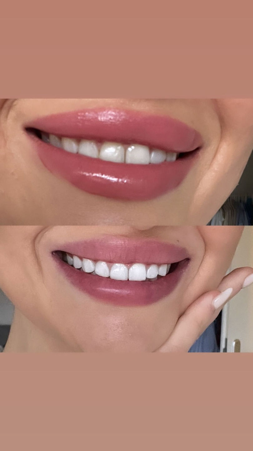 Farbkorrektur - Serum